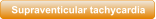 Supraventicular tachycardia