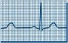 ECG readout