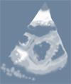 echocardiogram